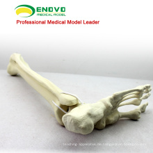 GROSSHANDEL SIMULATION KNOCHEN 12317 Medizinische Anatomie Künstliche Tibia mit Fußknochen, Orthopädie Praxis Simulation Knochen